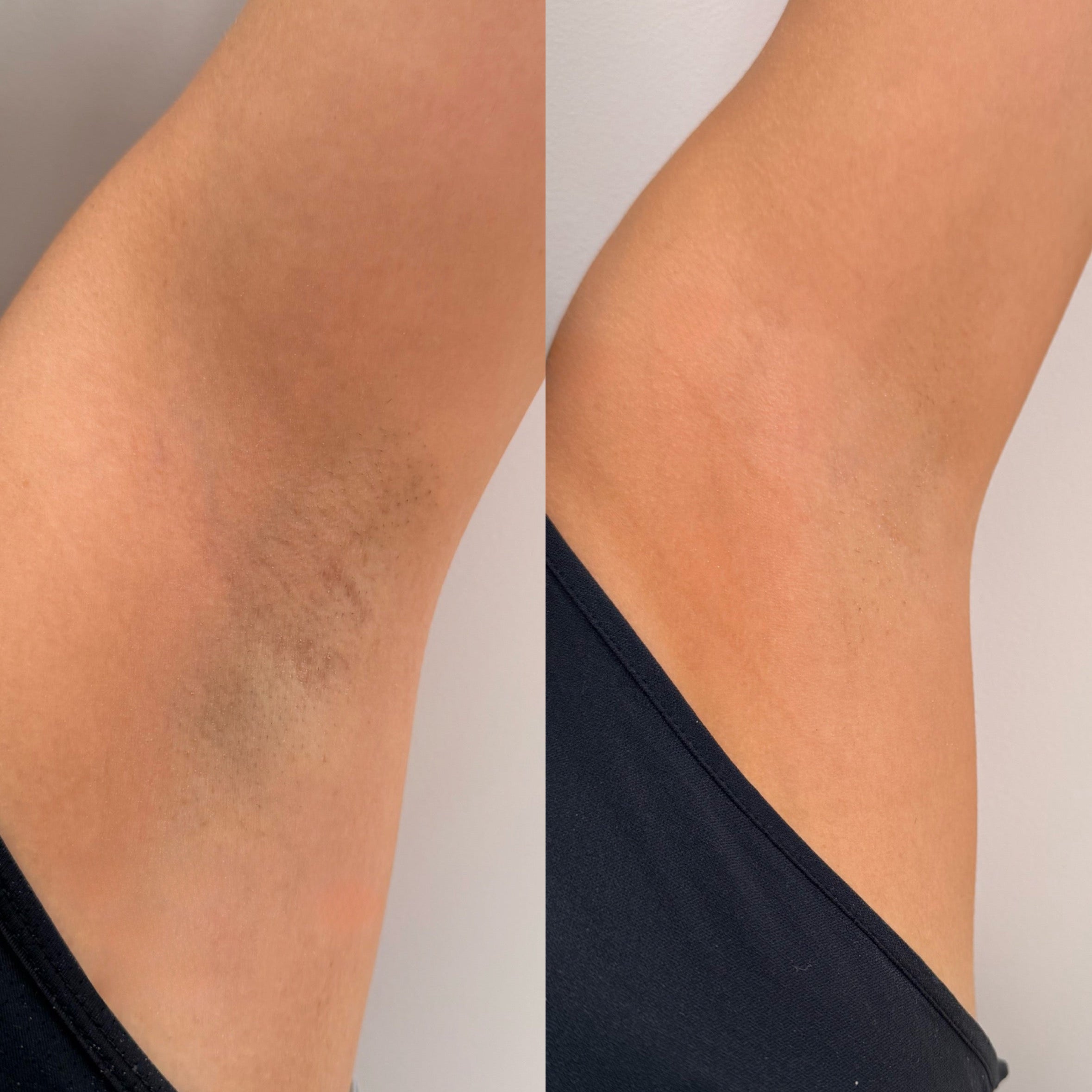 Blue Mist - Desodorante Antitranspirante Roll-On 55ml